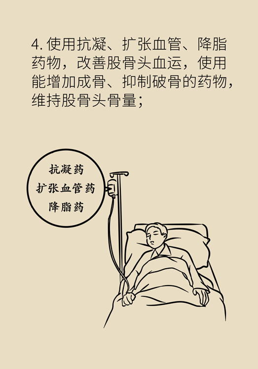 激素會(huì)帶來(lái)股骨頭壞死的后遺癥嗎？