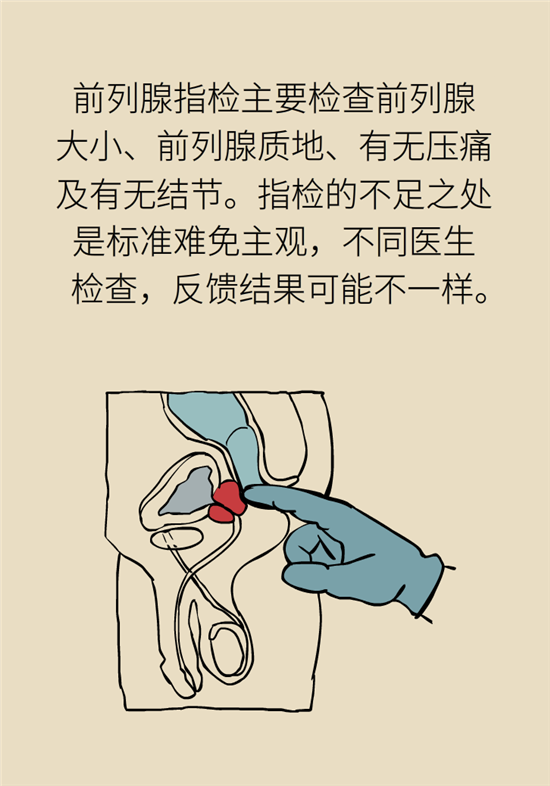 前列腺肥大了還能縮小嗎？