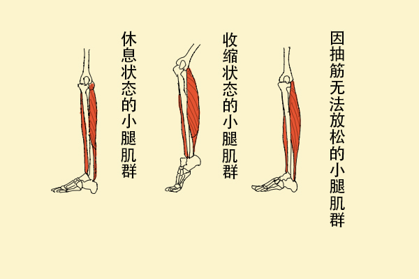 為什么缺鈣會(huì)導(dǎo)致抽筋？