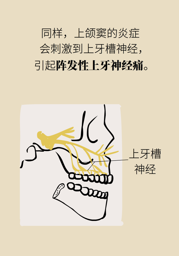 為什么鼻竇發(fā)炎，疼的卻是頭、眼和牙？