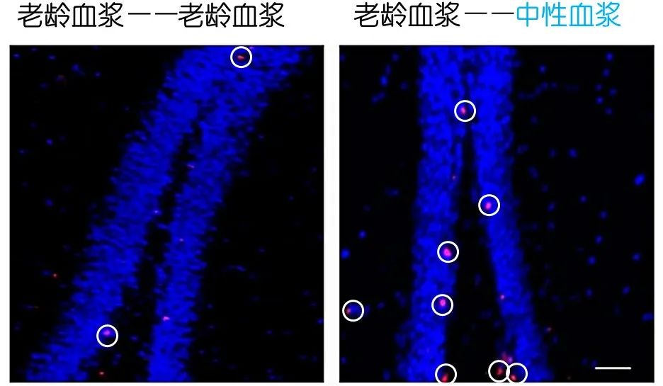 重返年輕不用大換血，只要給血液“兌點(diǎn)水”？