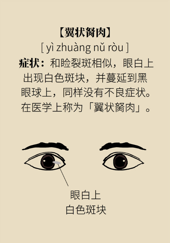 眼白有斑塊、出血要緊嗎？專家：名字唬人但問題不大