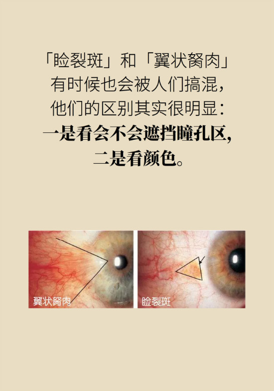 眼白有斑塊、出血要緊嗎？專家：名字唬人但問題不大