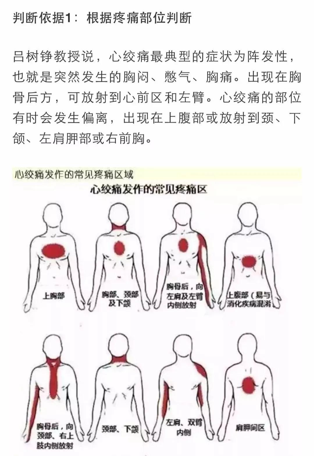 心梗有前兆！心臟發(fā)出的警報你在意了嗎？