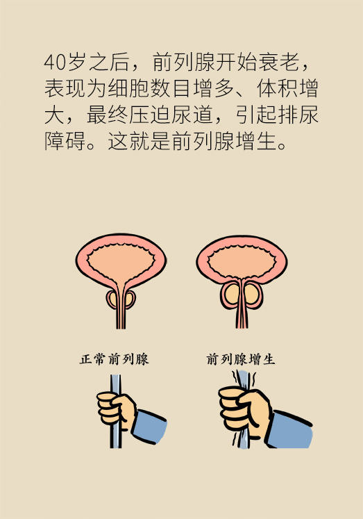 前列腺科普動(dòng)漫制作