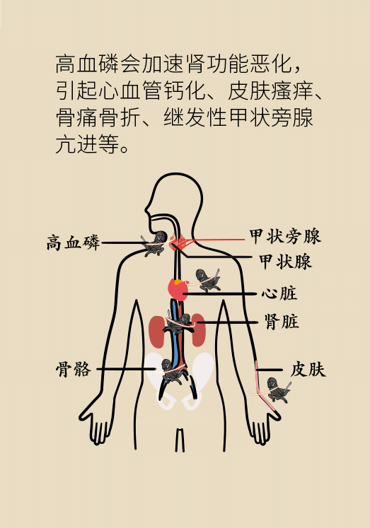 腎科普動漫制作