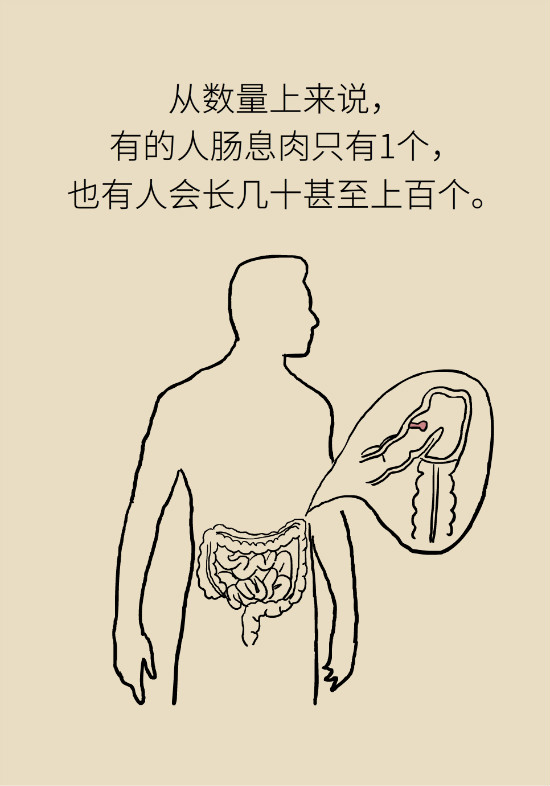 大腸癌科普動(dòng)漫制作