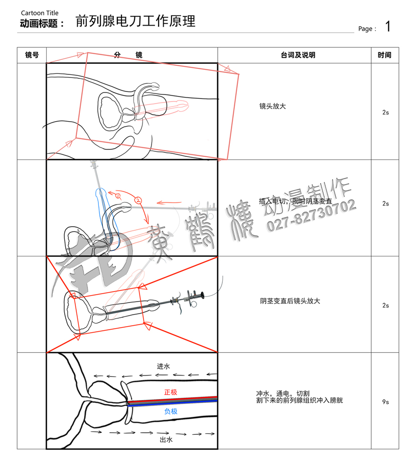 前列腺電刀工作原理.jpg