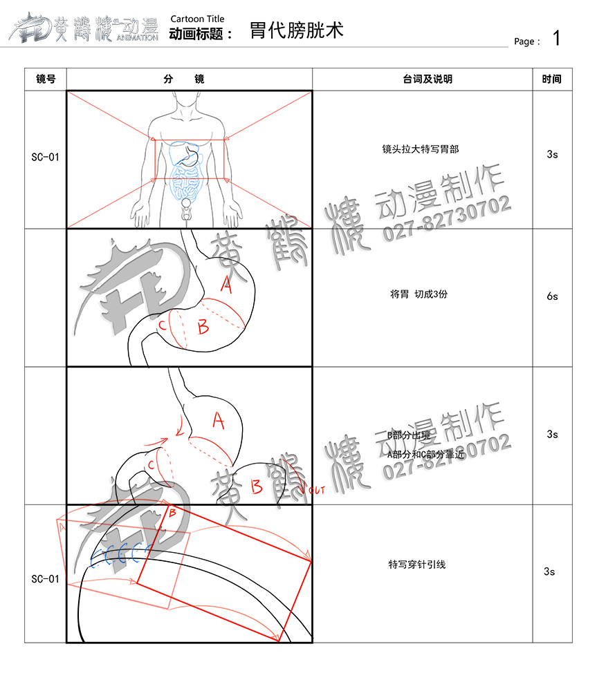 胃代膀胱術(shù)醫(yī)療手術(shù)動畫制作.jpg