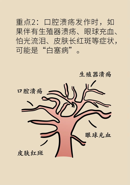 口腔潰瘍醫(yī)學知識科普動漫制作