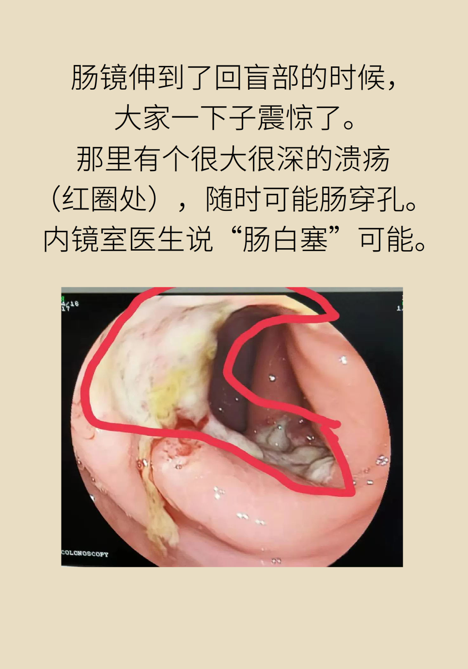 長白塞病醫(yī)學知識科普動畫制作