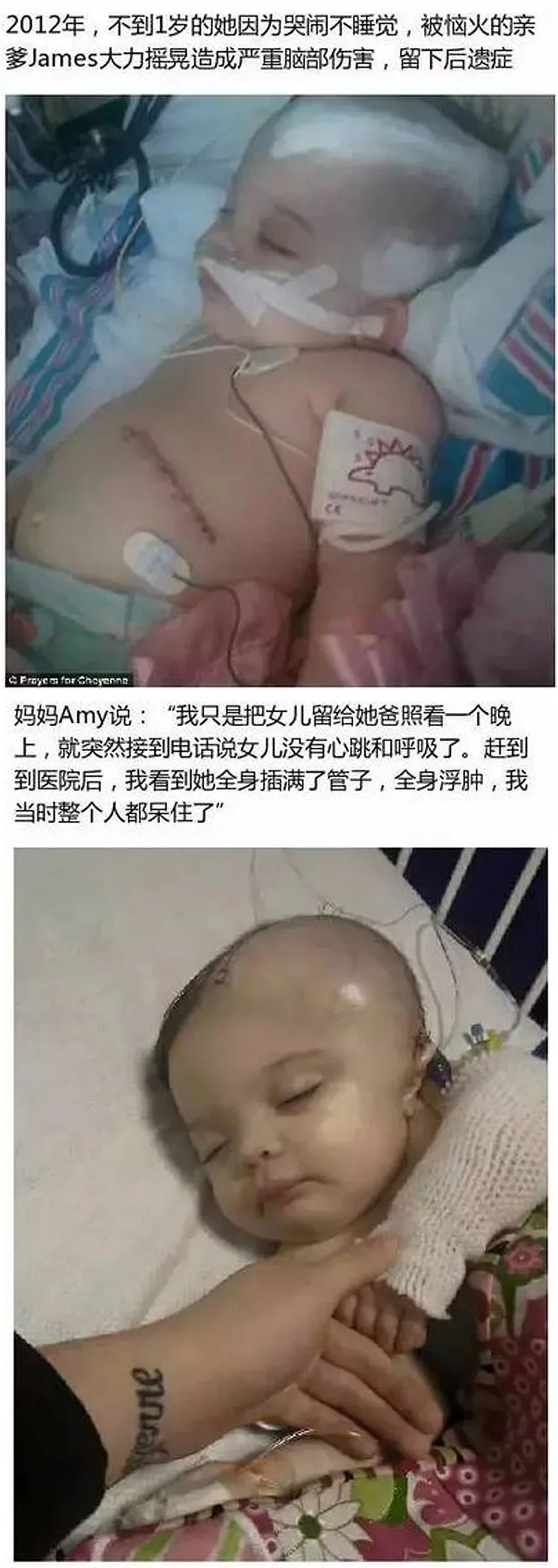 育兒醫(yī)學(xué)科普：大力搖晃會損傷寶寶的大腦致腦損傷