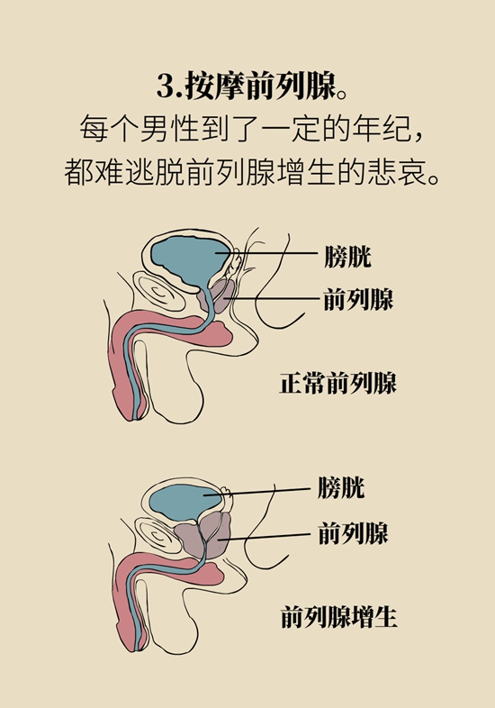 怎么做可以預(yù)防痔瘡呢？按摩前列腺、鍛煉盆底肌