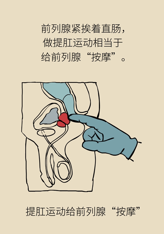 怎么做可以預(yù)防痔瘡呢？按摩前列腺、鍛煉盆底肌